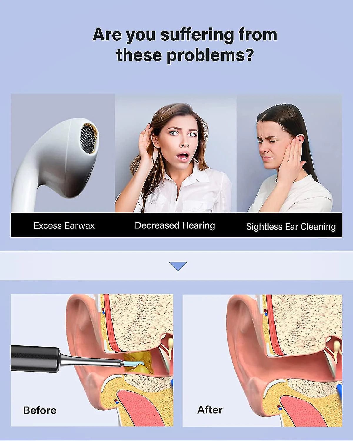 Ear Wax Remover Endoscope - EarView